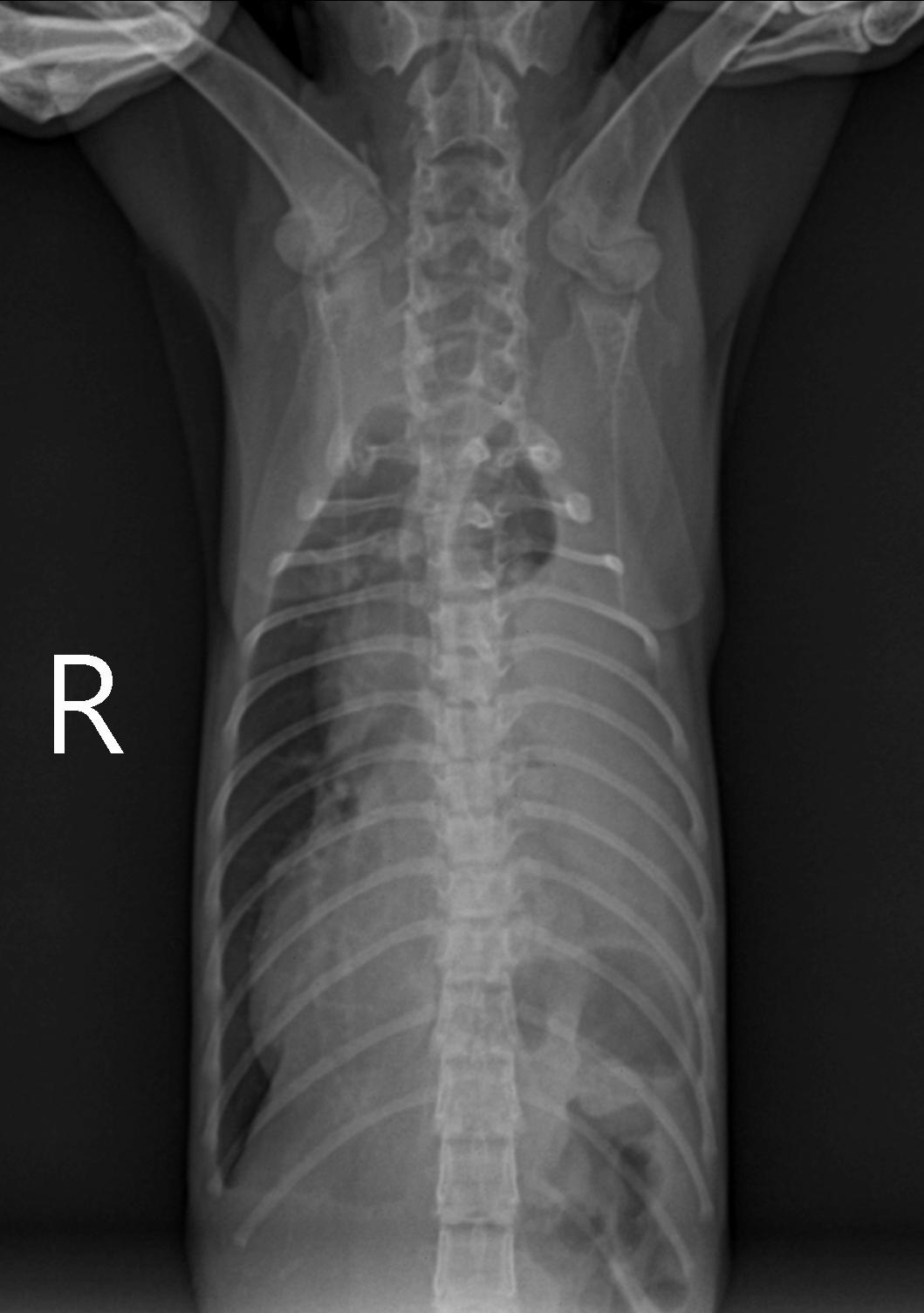 수술전 x-ray 1.jpg