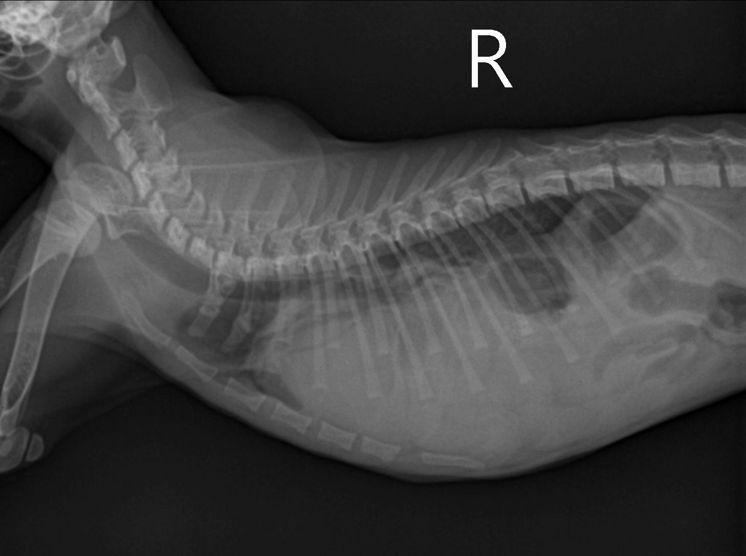 수술전 x-ray 2.jpg