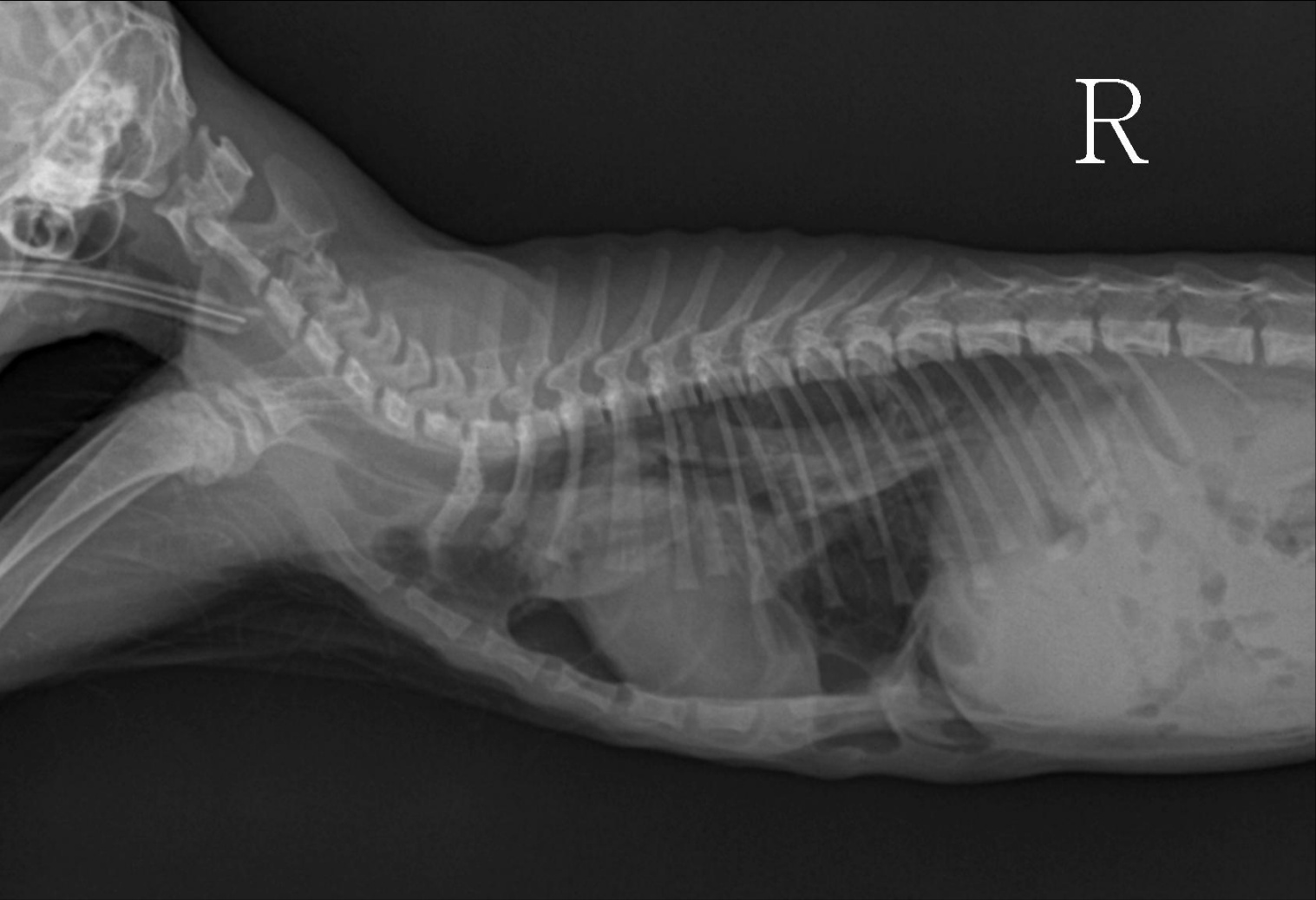 수술후 x-ray 1.jpg