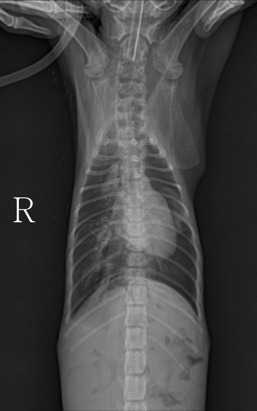 수술후 x-ray 2.jpg