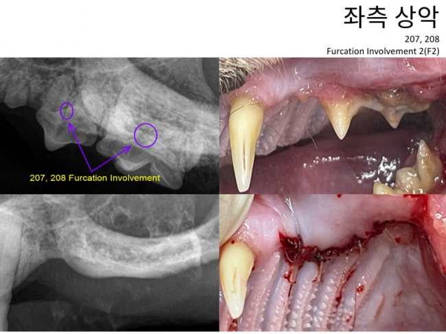 2차 좌악.jpg